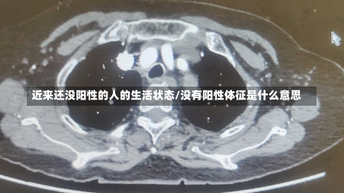 近来还没阳性的人的生活状态/没有阳性体征是什么意思